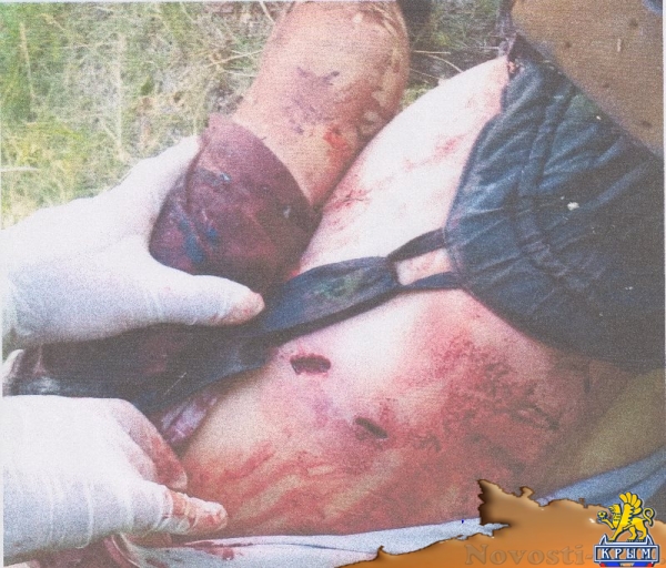 Донбасс: Им выкалывали глаза, чтобы признались, что русские (ФОТО) - «Происшедствия Крыма»