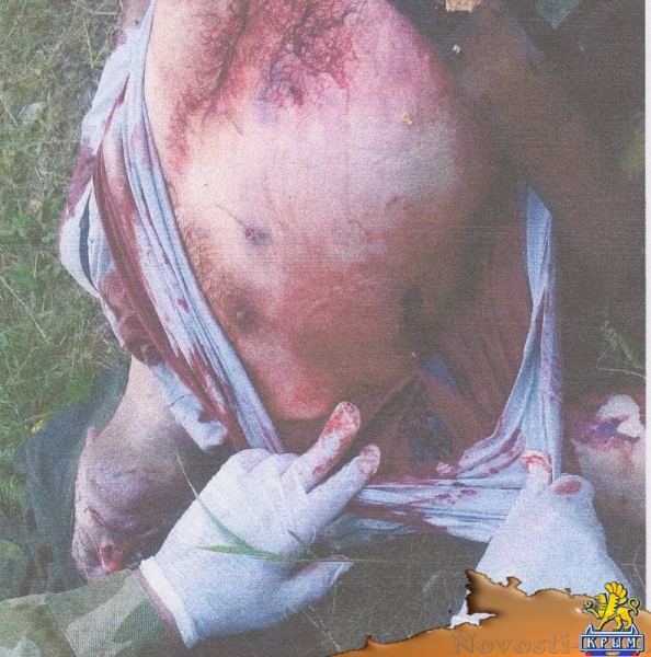 Донбасс: Им выкалывали глаза, чтобы признались, что русские (ФОТО) - «Происшедствия Крыма»