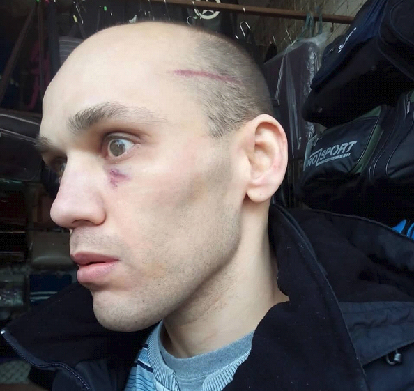 В Крыму избили джанкойского инвалида — плюнул в «депутата» Госдумы Шеремета - «Новости Крыма»
